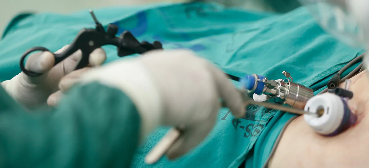 Laparoscopic Adhesiolysis in Bangalore