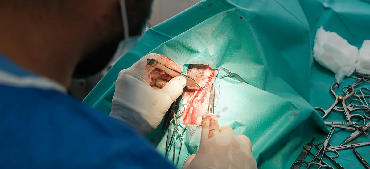 Laparotomy